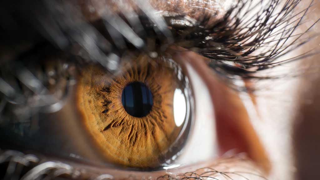 Image for Glaucoma Up-Close