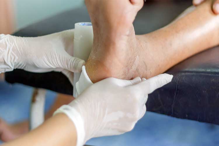 Diabetic foot being treated