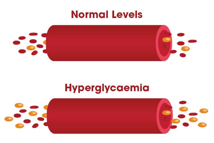 hyperglycaemia diagram