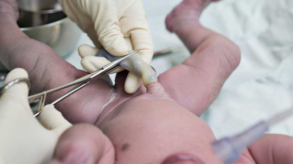 Cutting The Umbilical Cord Ausmed