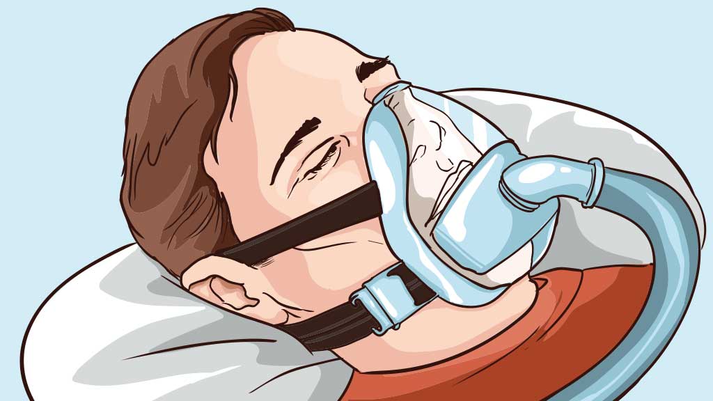 Forms Of Non Invasive Ventilation