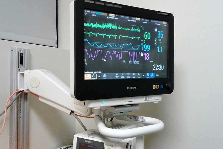 cardiac monitor that contiusly monity st elevation