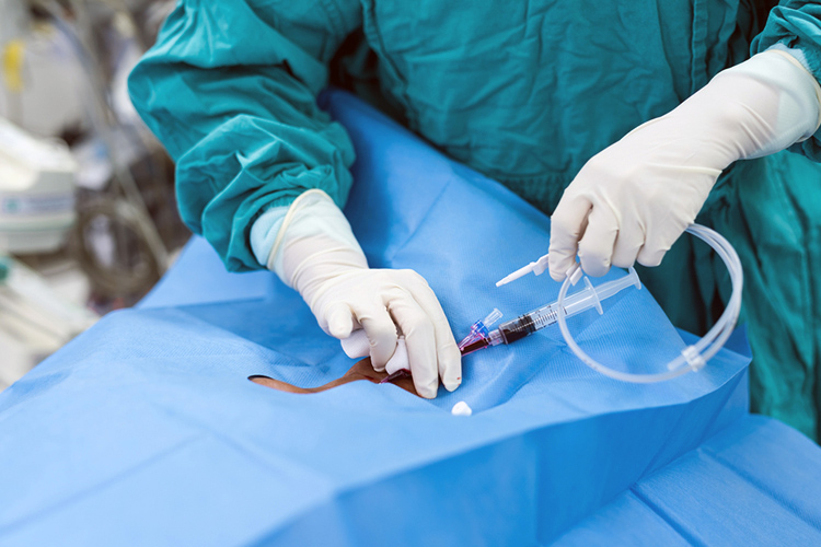 A central line being inserted