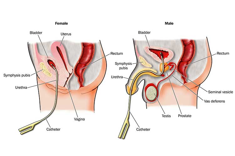 urinary catheter insertion diagram