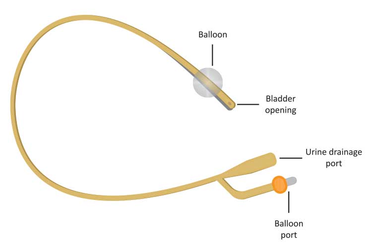 urinary catheter diagram