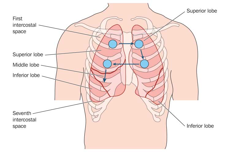 Chest Auscultation: PaliwanagChest Auscultation: Paliwanag  