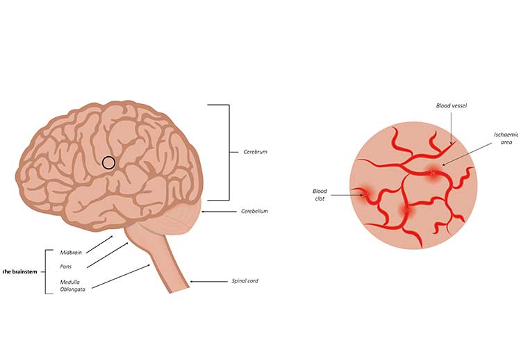 tia diagram