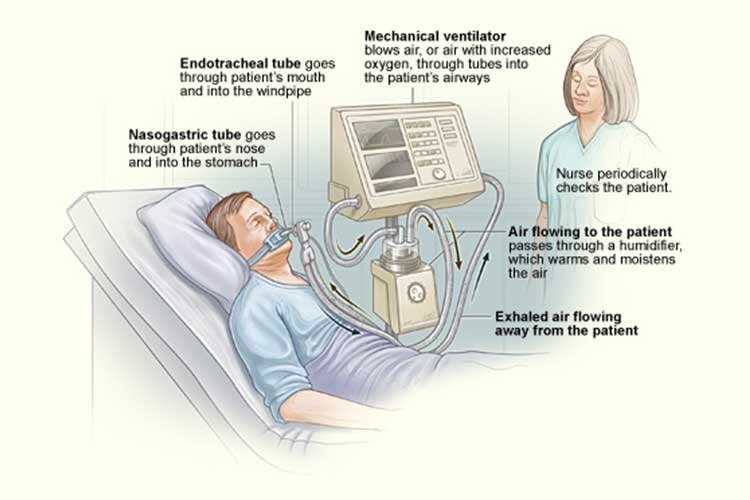 ventilator diagram