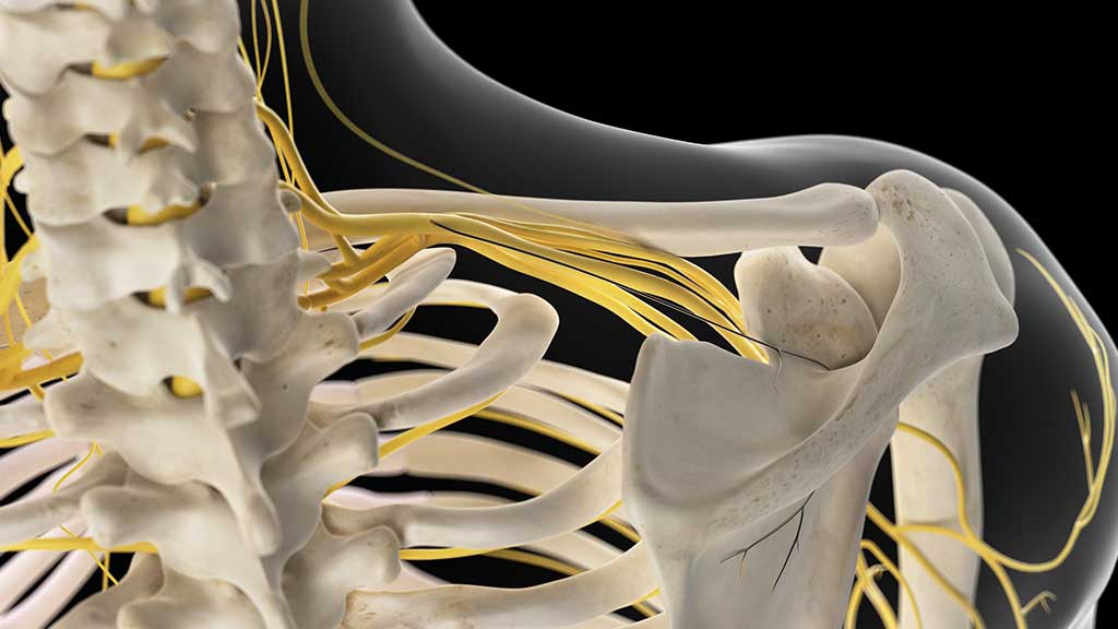 Brachial Plexus Injuries Care And Treatment Ausmed