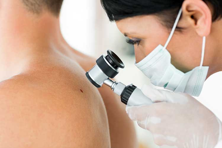 examining for skin cancer