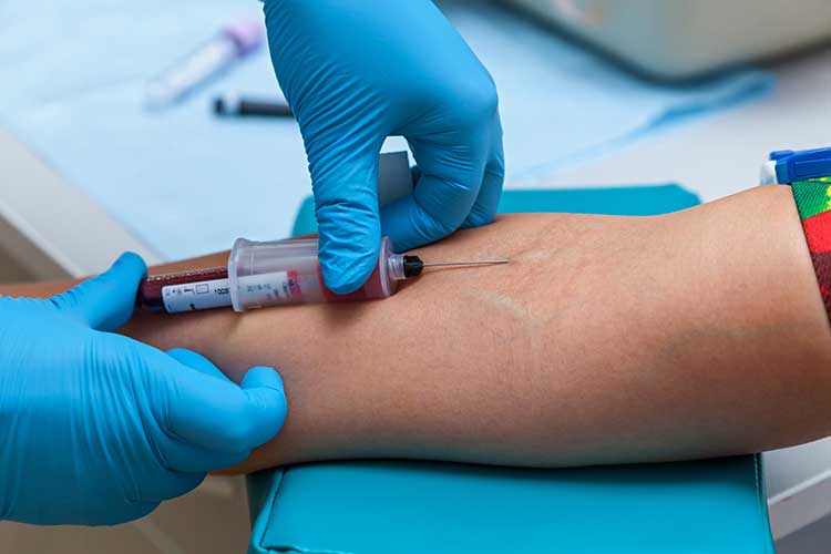 implied consent: client having blood sample taken