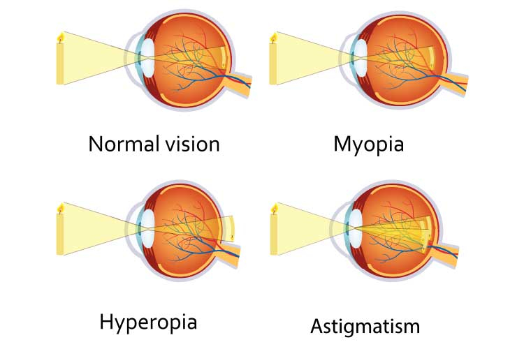 Caring for Clients with Glasses and Contacts | Ausmed