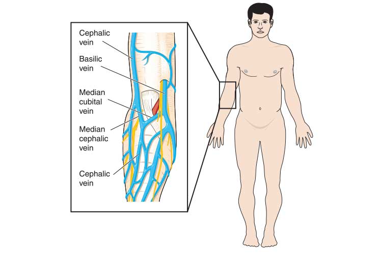 antecubital fossa (ACF) vein cannulation sites diagram