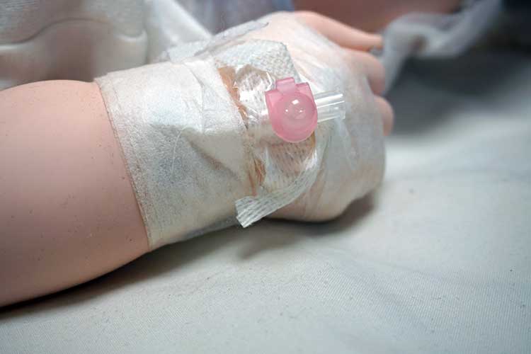 infant iv cannula in-situ