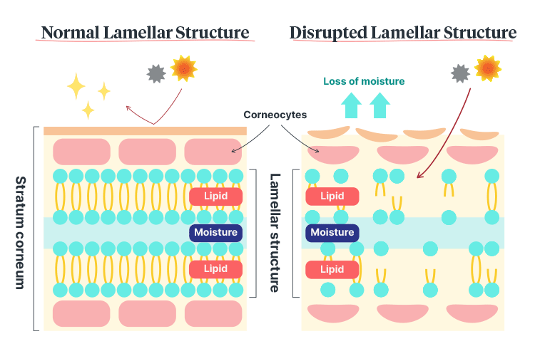 xerosis stratum corneum diagram