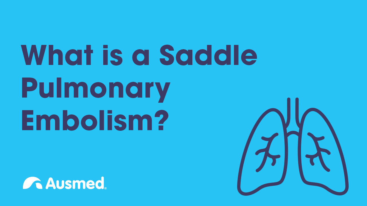 what-is-a-saddle-pulmonary-embolism-pe-ausmed